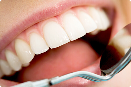 かみ合わせにおける歯の治療について